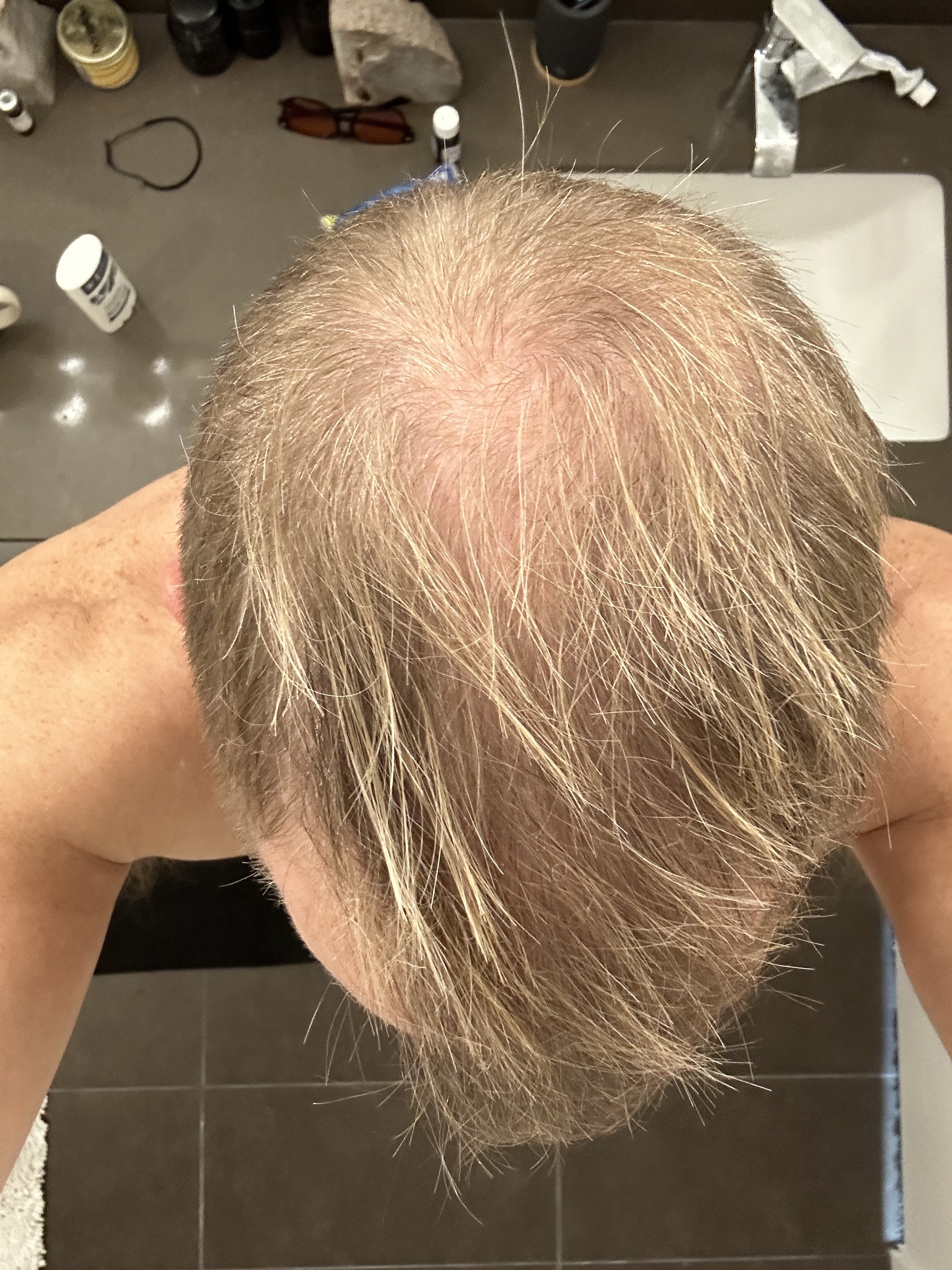 5 Months
